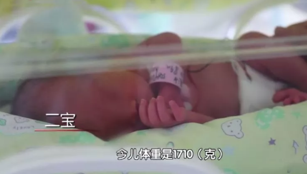 3年生3胎又怀3胞胎