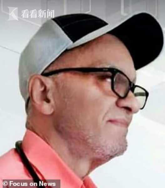 巴西女子砍下丈夫生殖器煮汤